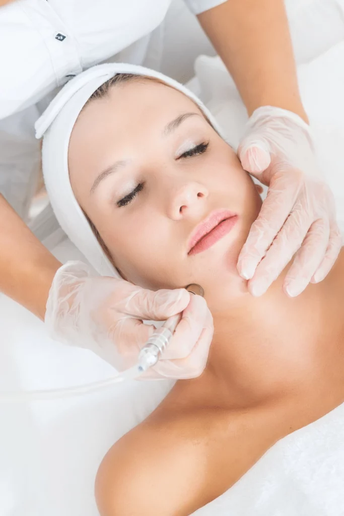 microdermabrasion