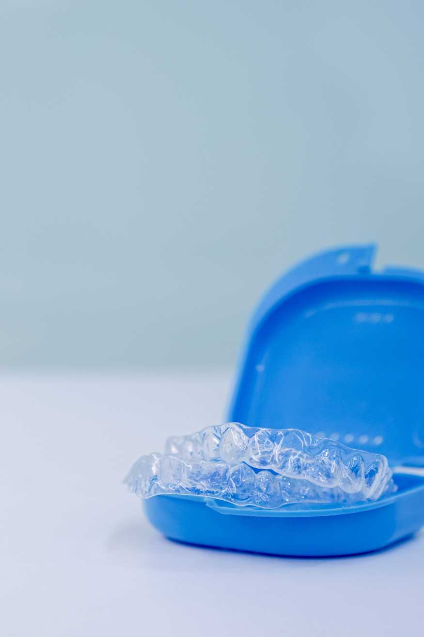 Everything You Need To Know If You Are Considering Invisalign